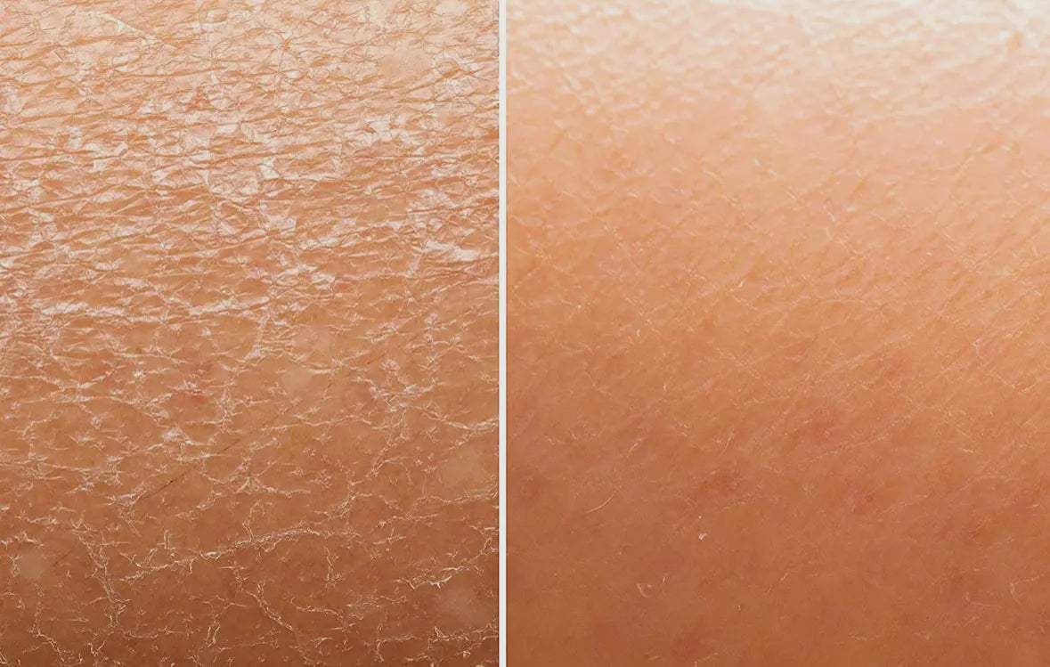 Flawsome Cellulite Reducing Skin Smoothing Coffee Scrub
